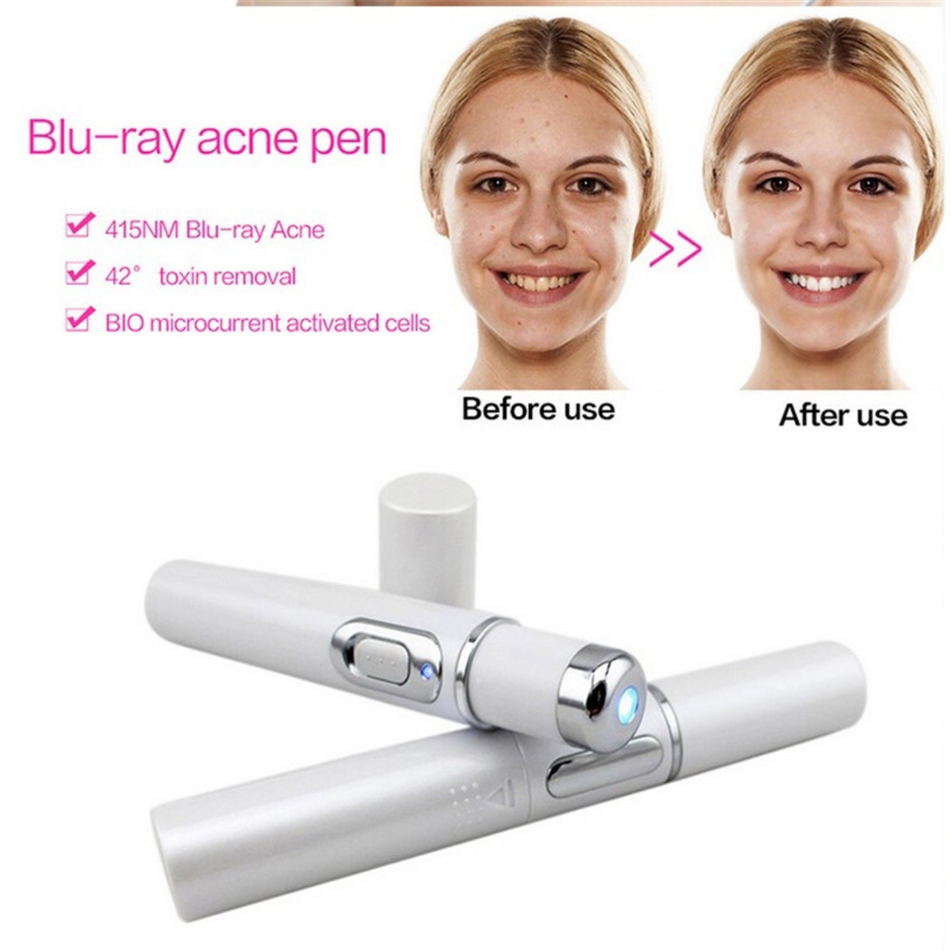 Blue Light Therapy Pen