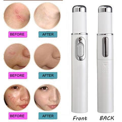 Blue Light Therapy Pen
